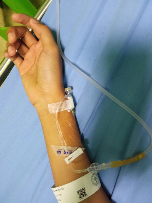 ท่อน้ำนมอุดตันเต้านมอักเสบจนต้องกรีด