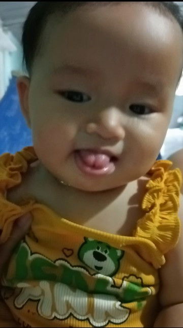 Cho em hỏi như thế này là bị dính thắng lưỡi đúng không ạ 
Bé 6 tháng