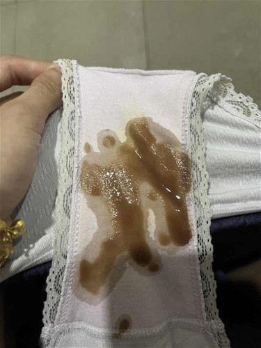 Lendir coklat banyak