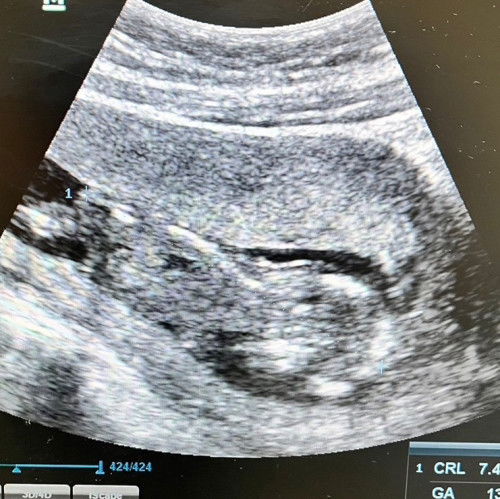 ดูเหมือนน้ำคร่ำน้อยไหมคะ