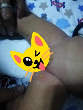 Ano po kaya ito? Ano pwedi igamot?