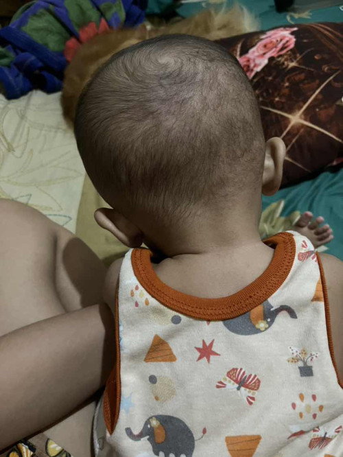 Kepala baby sering miring