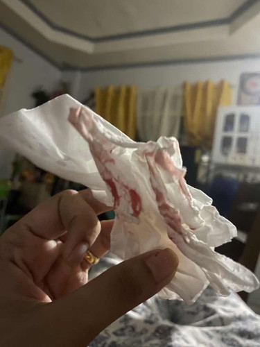 Heavy Bleeding