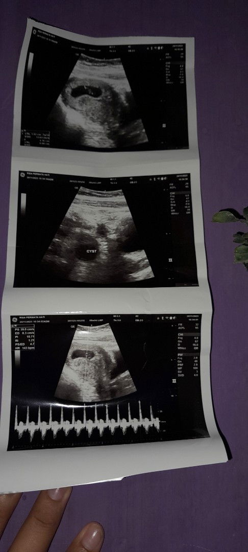 Bantu Jawab Bunddd Hehehe