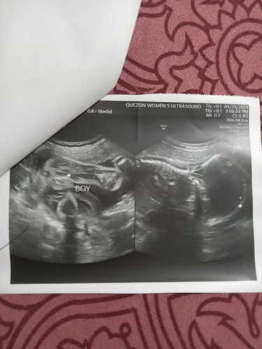Mga mii , Sure na po kayang baby boy sya ?