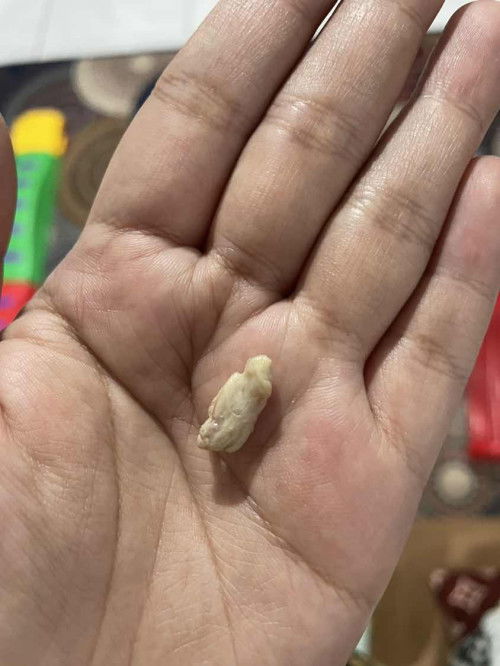 Keluar gumpalan putih