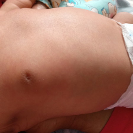 Salam,sya nk bertnye ada MaMa2 dlm ini anak mcm anak,anak kedua sya girl tetek bekak masuk ke dlm