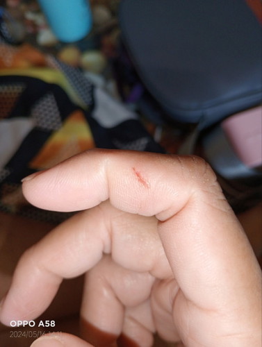 Pwede po ba mag pa antirabies ang buntis?
17 weeks pregnant po