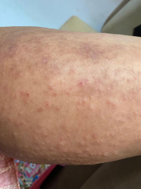 Gatel gatel setelah melahirkan