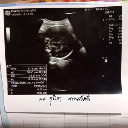 กำหนด 9 มิถุนายน