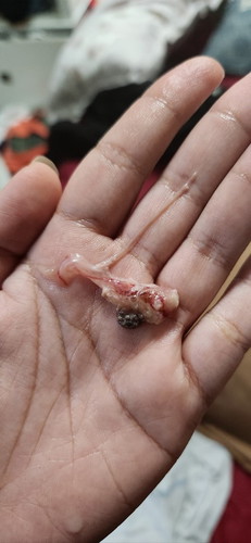 Lendir darah tapi ada mcm biji hitam
