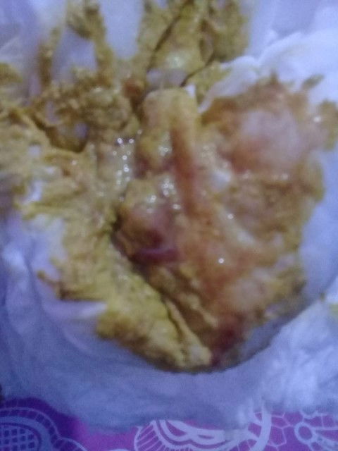 Tolong jawab ia bun aku mohon aku sedih bgt lihat anak go smbuh2🥺😢😭......