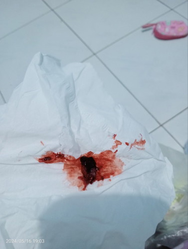 Pas di USG udah 5 Minggu tapi keluar darah kaya haid dikasih obat penguat sama vit