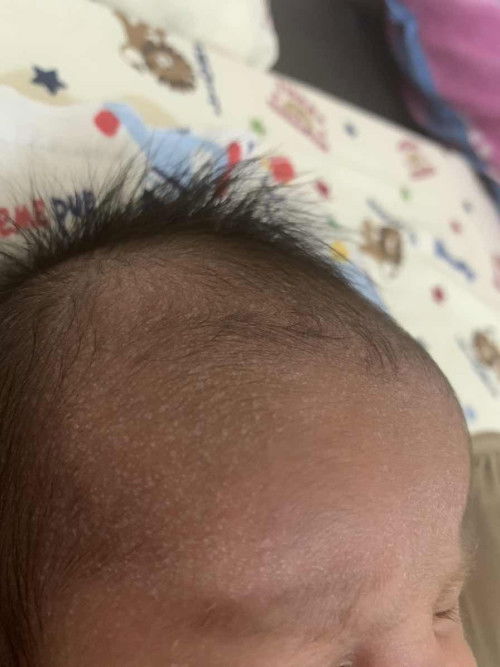 Bintik putih dikepala baby