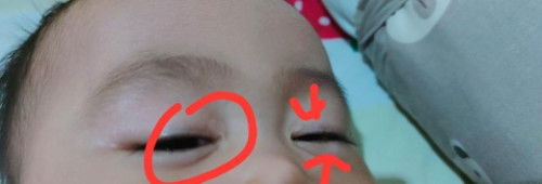 barangkali ada pengalaman yg sama di luar mata anak ada seperi bercak putih kyk ini . Ini knp ya?