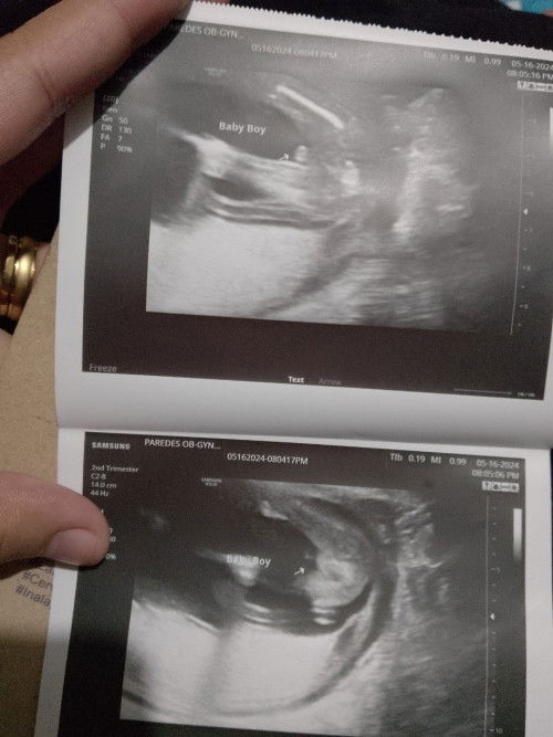 17w2d 🩵 it's a baby boy! 🩵🩵🩵