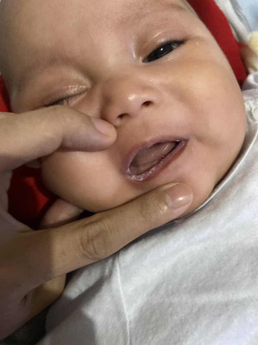 Putih" di bbir vayi 2 bulan 20hari