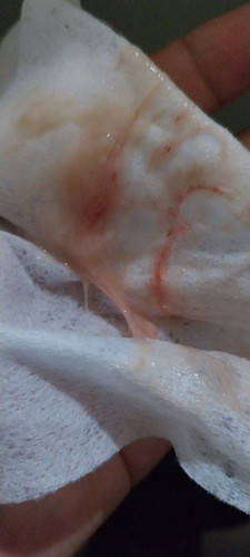 Mucus plug?