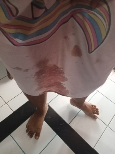 แท้งคุกคาม