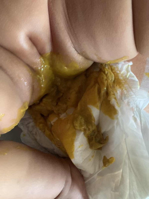 3เดือนอึแบบนี้ปกติมั้ยคะ