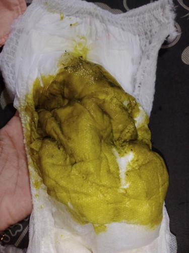 Kerap berak