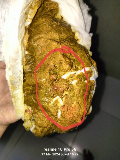 Pup bayi ada bulet2 merah