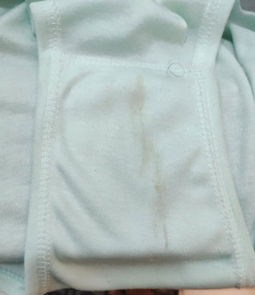 Ini Flek atau bukan ya Bun ?