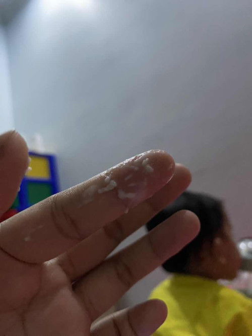 keputihan usia kehamilan 36w2day