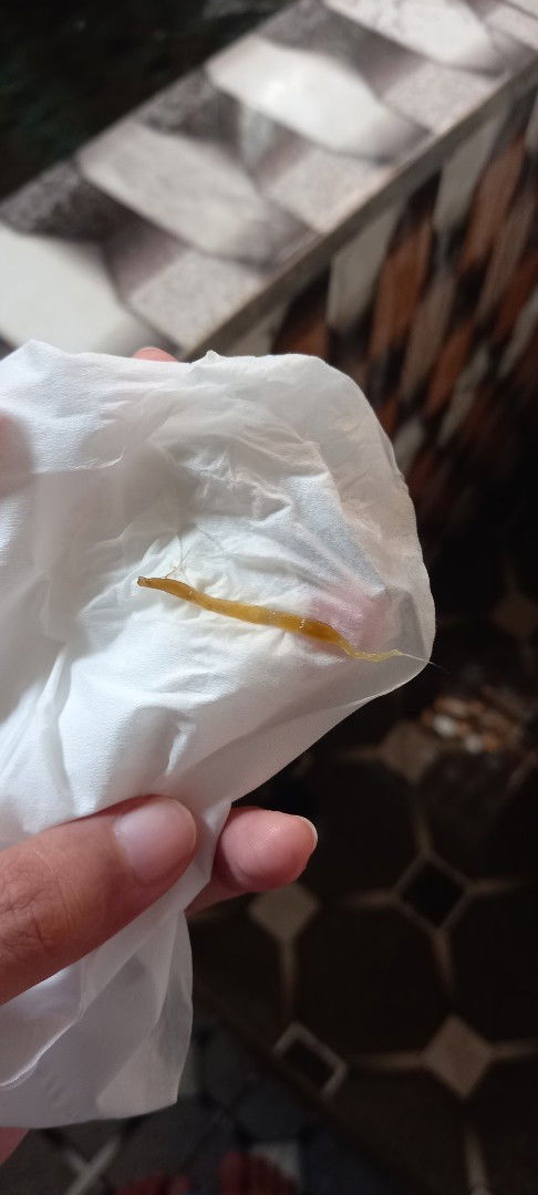 Keluar sesuatu pas lagi BAB