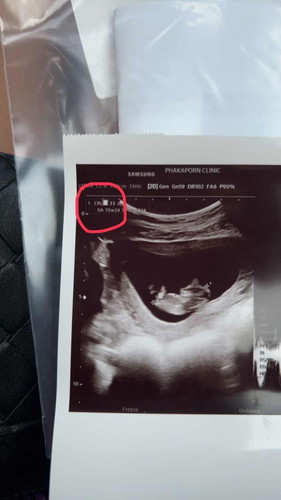 แม่ๆ 10 วีค ลูกตัวโตเท่าไรกันบ้างคะ