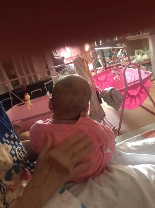 น้อง4เดือนเต็มแล้วค่ะ หัวน้องแบนมากคุณแม่มีวิธีไหนช่วยได้บ้างค่ะ