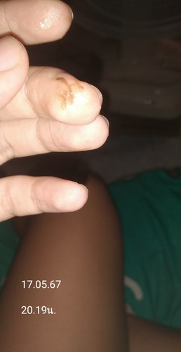 แบบนี้คือใกล้จริงๆแล้วใช่มั้ยคะ