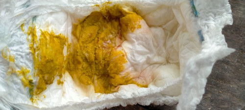 ขออนุญาตสอบถามนะค่ะ