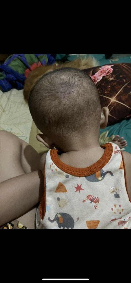Kepala baby 6 bulan suka miring2