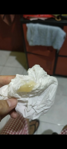 Ini keputihan atau apa ya kak? Usia 38 minggu keluar seperti ini kak