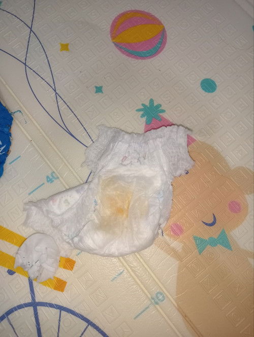 Air kencing berwarna Oren pekat