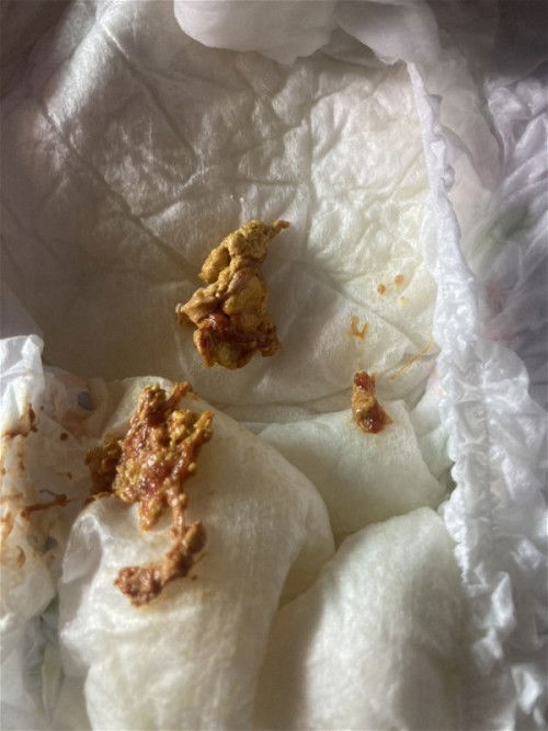 ขับถ่าย สีอึของน้อง