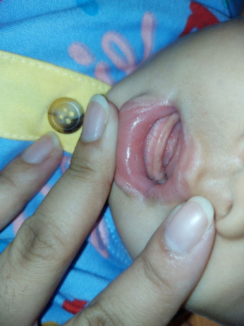 1stime mom here 👋 Pag ganto na po ba ang gums ni baby, nag ngingipin na po ba to?