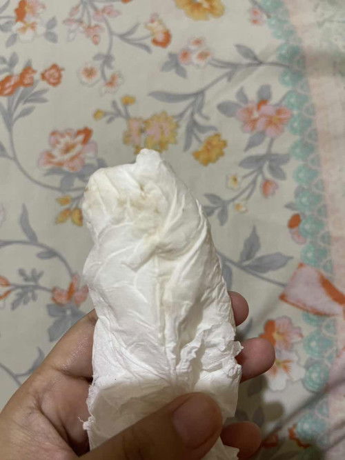 Flek usia kehamilan 9 minggu