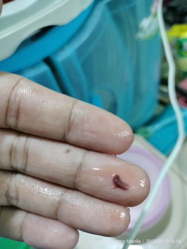 28 weeks may lumalabas na ganito.