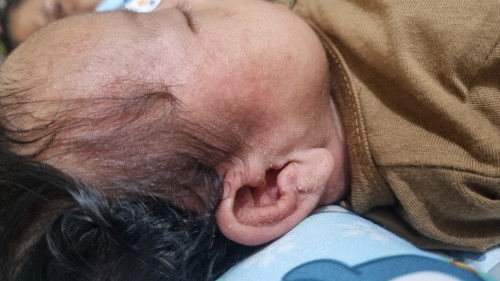 Telinga anak keluar cairan putih² dan berbau