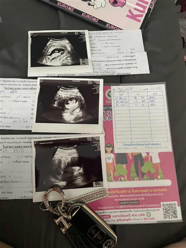 อัลตร้าซาวด์บ่อยอันตรายมั้ยคะ