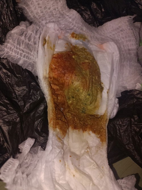 kenapa pup anak aku kayak gini?