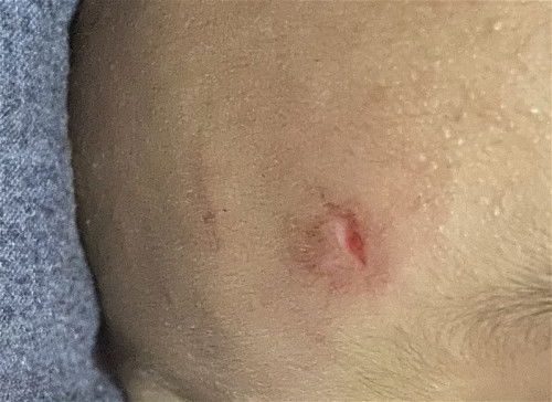 anak jatuh jidat kena batu