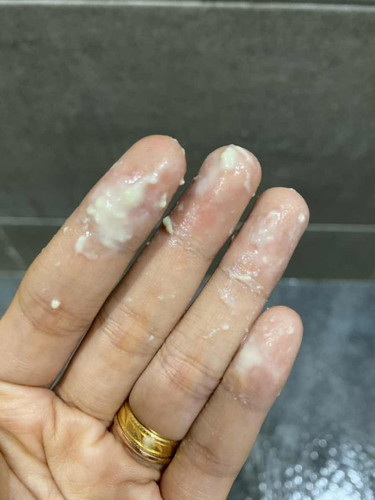 Keputihan yang saya alami