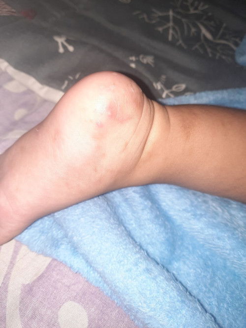 Kaki anak kenapa ya?