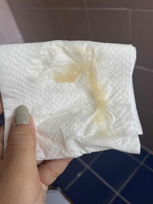 ตั้งครรภ์ได้11week 6days แล้วค่ะ แต่ดันเป็นตกขาวไม่แน่ใจว่าปกติมั้ยนะคะ