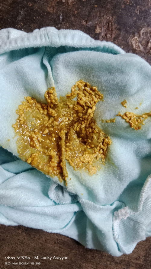 Fases bayi dua bulan