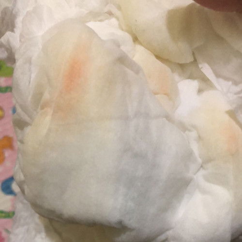 Bahaya atau tidak ya bund