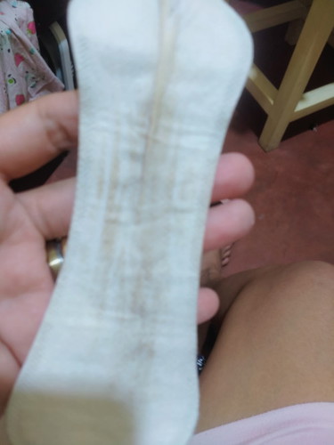 Good pm po mga mommies. should I be worried?